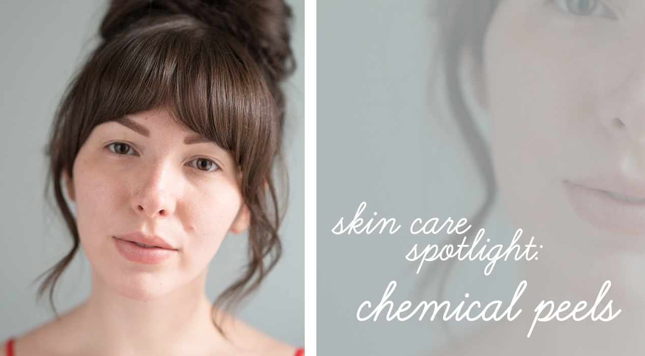 Skin Care Spotlight Guide to Chemical Peels Keiko Lynn image